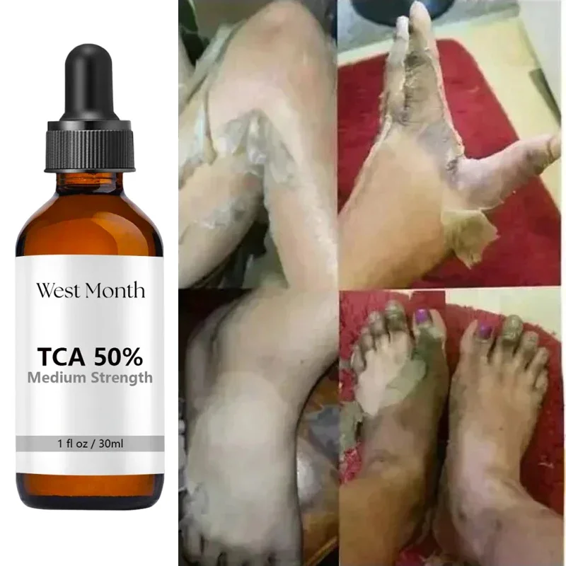 PWYUMAN TCA & Glycolic Acid Peeling Serum with Peppermint – Brightening - Image 3