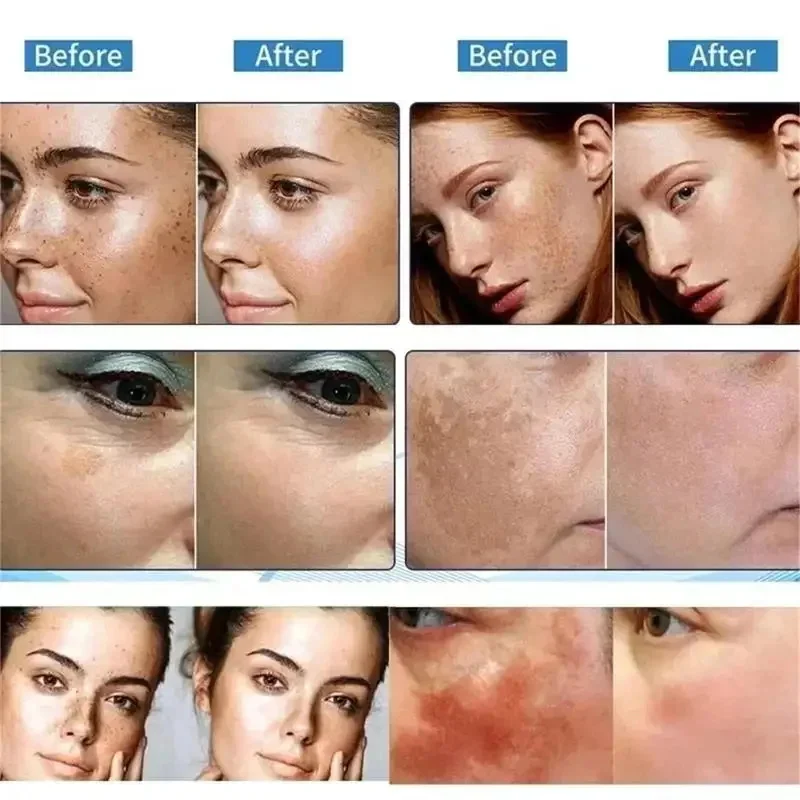 Niacinamide Brightening Cream Gel – 20 ml Spot‑Removing, Moisturizing Formula (Unisex) - Image 2
