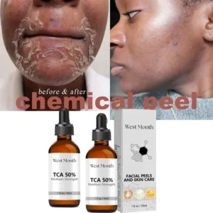 PWYUMAN TCA & Glycolic Acid Peeling Serum with Peppermint – Brightening