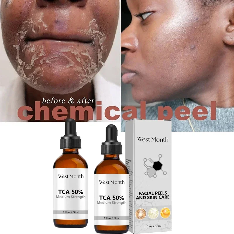 PWYUMAN TCA & Glycolic Acid Peeling Serum with Peppermint – Brightening