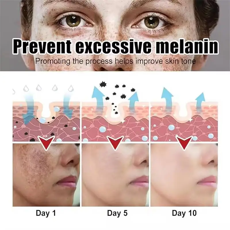 Niacinamide Brightening Cream Gel – 20 ml Spot‑Removing, Moisturizing Formula (Unisex) - Image 4