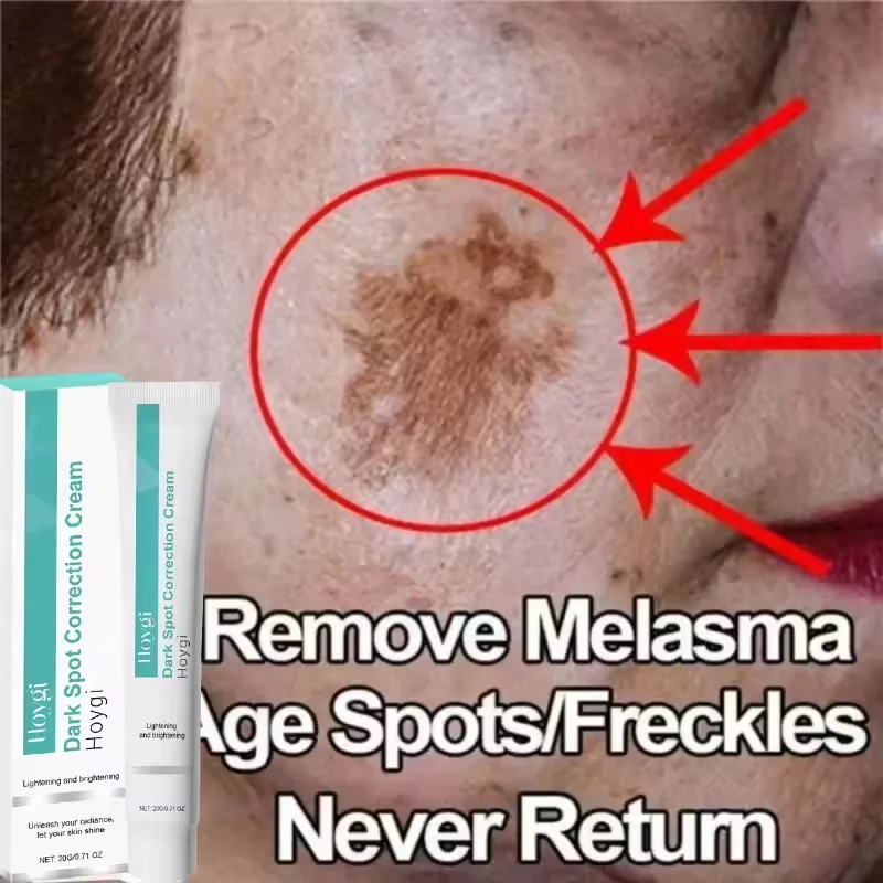 Niacinamide Brightening Cream Gel – 20 ml Spot‑Removing, Moisturizing Formula (Unisex) - Image 3