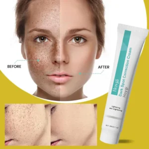 Niacinamide Brightening Cream Gel – 20 ml Spot‑Removing, Moisturizing Formula (Unisex)