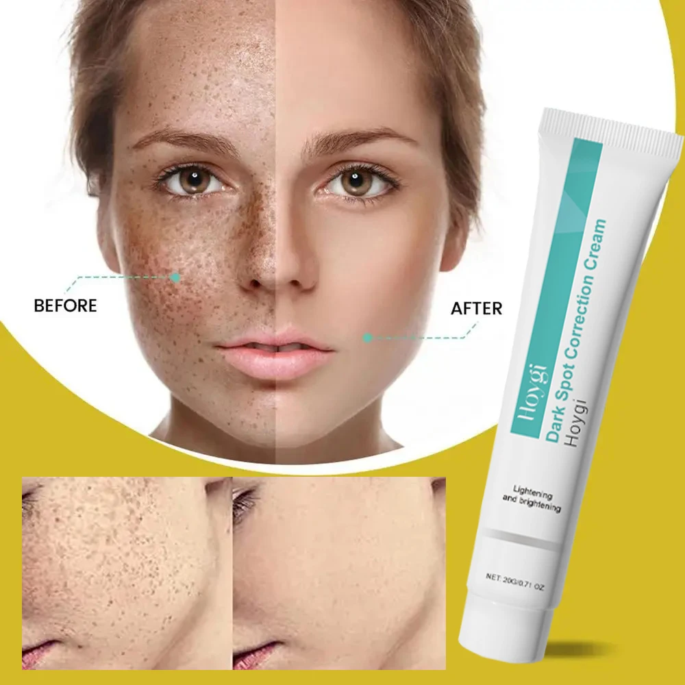 Niacinamide Brightening Cream Gel – 20 ml Spot‑Removing, Moisturizing Formula (Unisex)