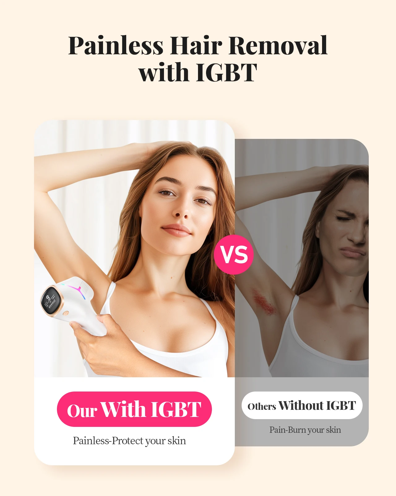 990,000‑Flash IPL Hair Removal Device, 9 Energy Levels, 5.2 cm² Window - Image 5