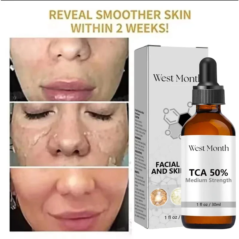 PWYUMAN TCA & Glycolic Acid Peeling Serum with Peppermint – Brightening - Image 4