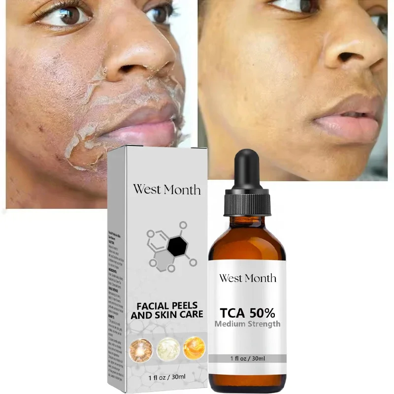 PWYUMAN TCA & Glycolic Acid Peeling Serum with Peppermint – Brightening - Image 7